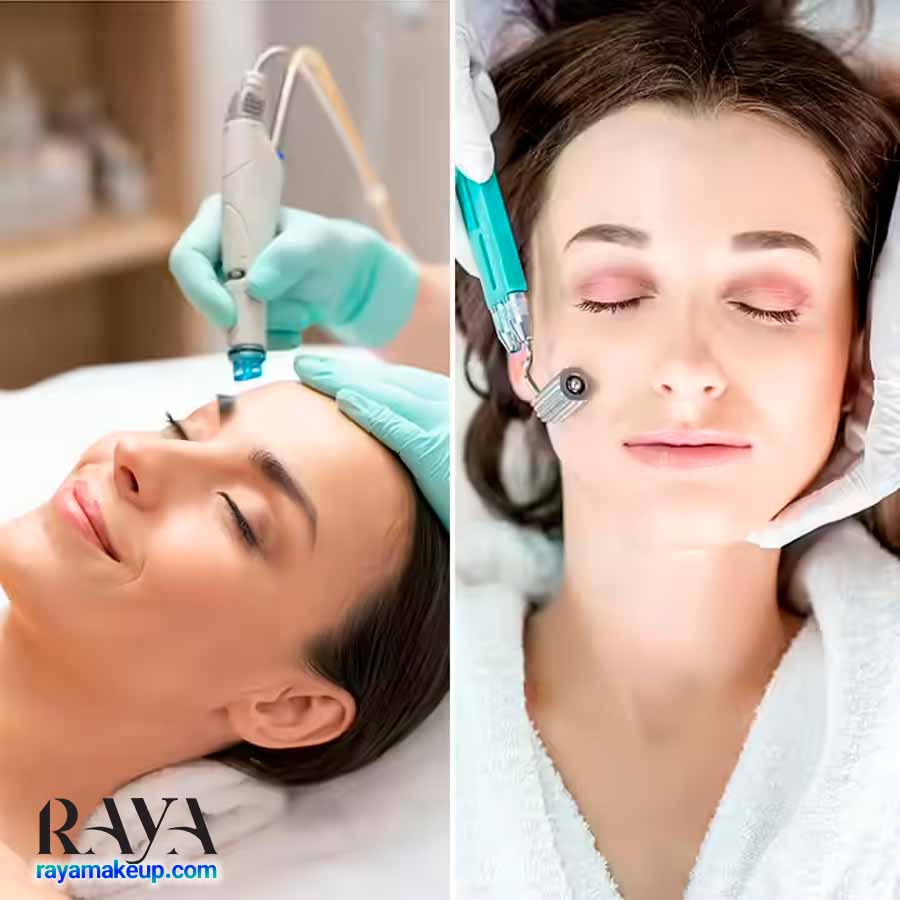 نکات مهم و تفاوت های میکرونیدلینگ و میکرودرم ابریژن