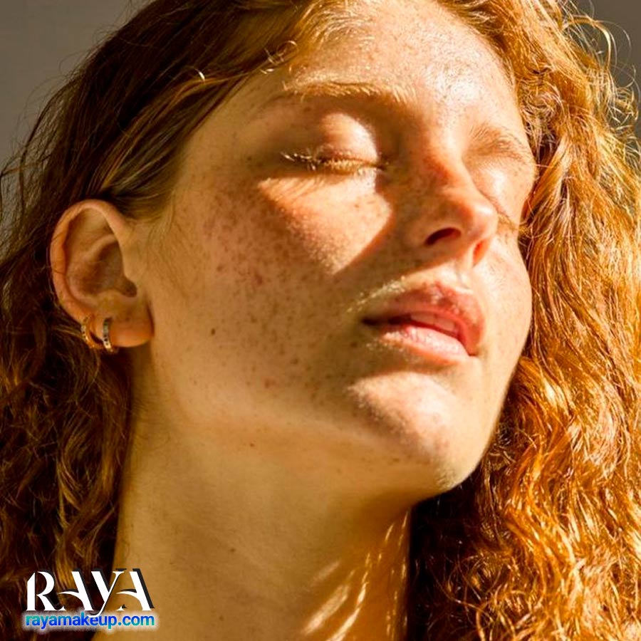 چرا پوست صورت ما تیره تر از پوست بدن است؟ علل، درمان و راه حل های موثر