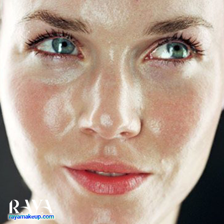 راهکارهای رفع چربی بیش از حد بینی 