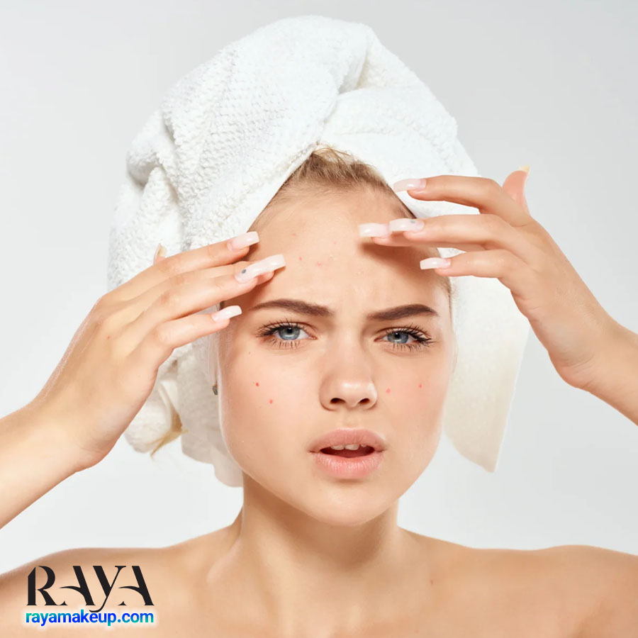 چگونه از جوش زدن جلوگیری کنیم؟