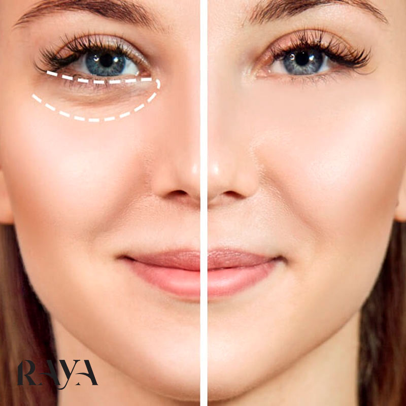 دلایل تیرگی پوست دور چشم و روش های ساده برای رفع تیرگی دور چشم