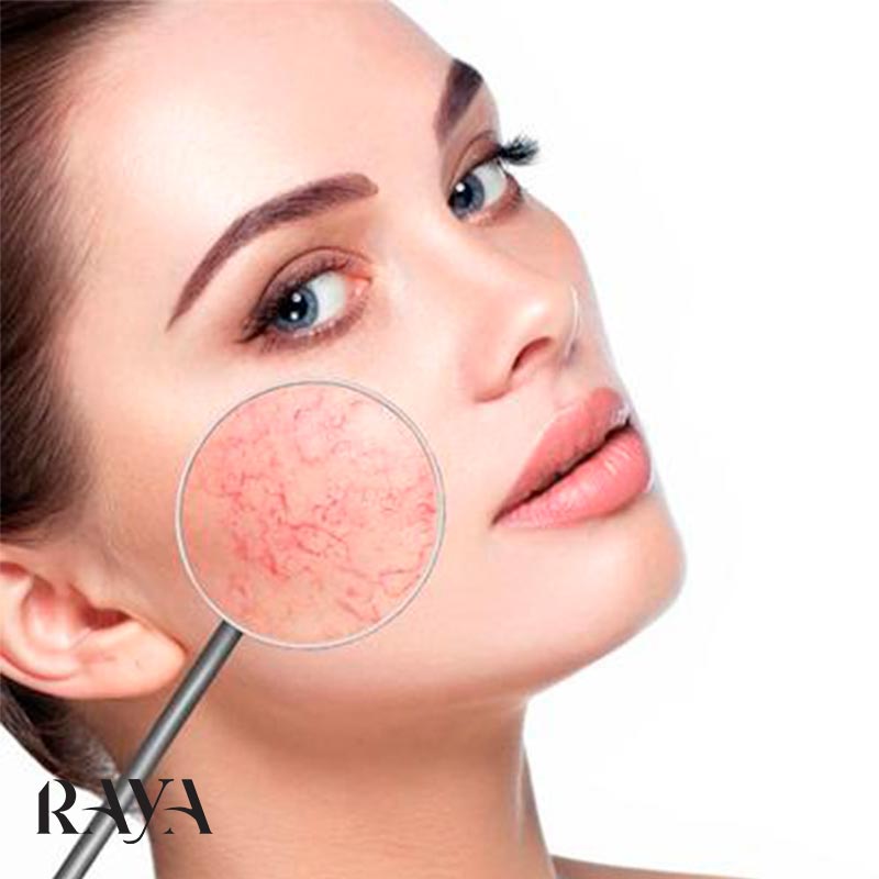 مراقبت از پوست های حساس و آسیب دیده و مشکل دار